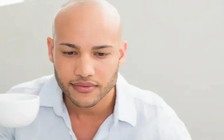 How to Embrace Being Bald in Your 20s...With Style