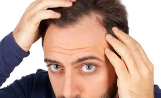 Receding Hairline: Stages, Causes, Treatments & Solutions