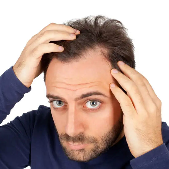 Receding Hairline: Stages, Causes, Treatments & Solutions
